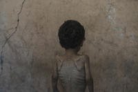 APTOPIX Mideast Wars Dying of Hunger