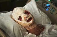 Matt Hagen lies in a hospital bed with his face heavily bandaged in DC Studios’ Clayface trailer. (DC/Warner Bros. Pictures)